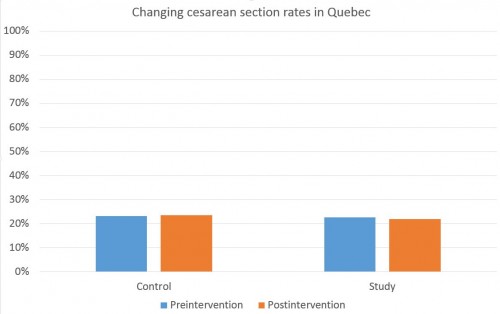 C section